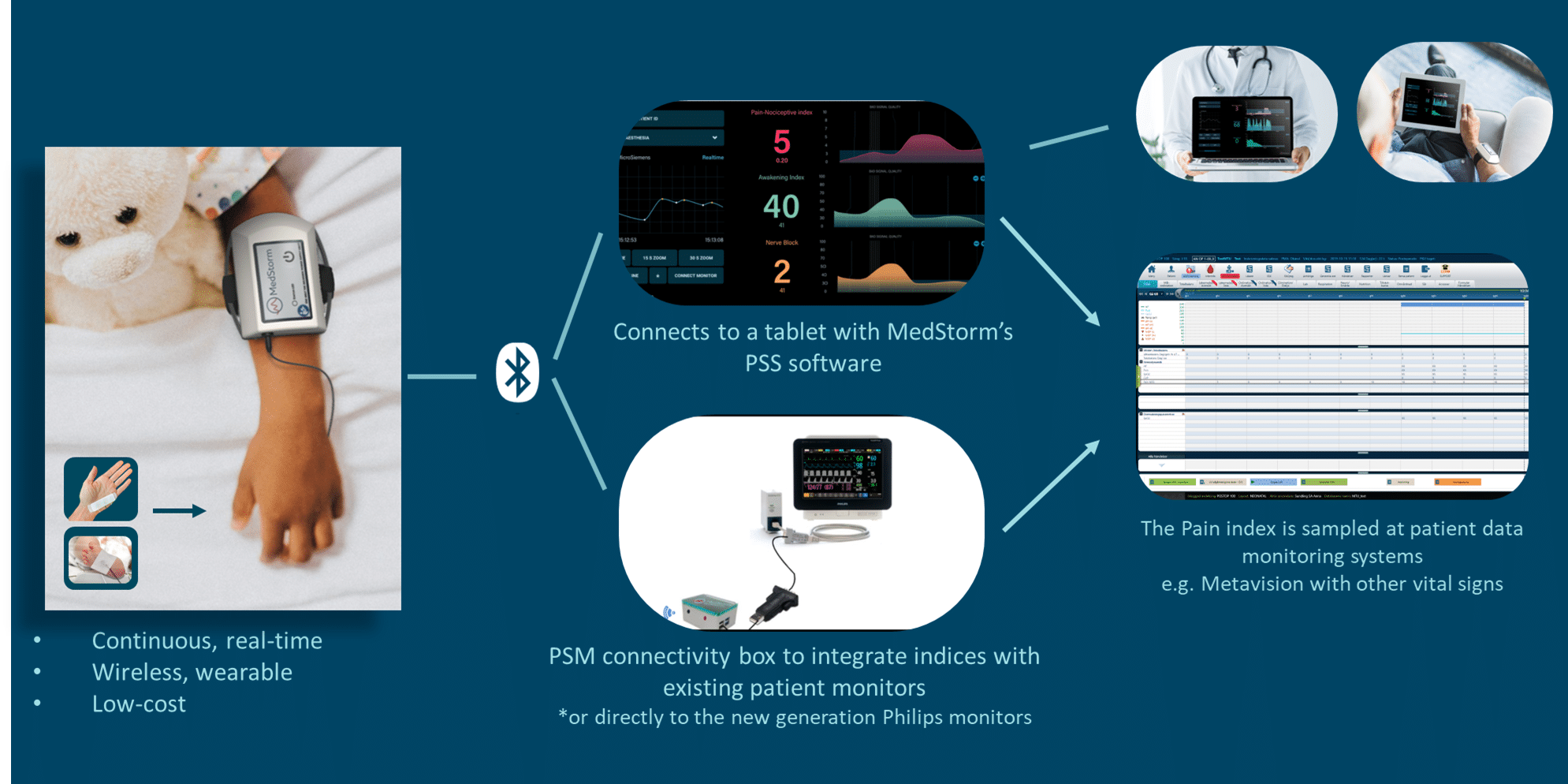 MedStorm PainSensor | MedStorm